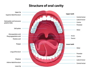 Oral Cavity Structure - UPPP Surgery for Severe Sleep Apnea