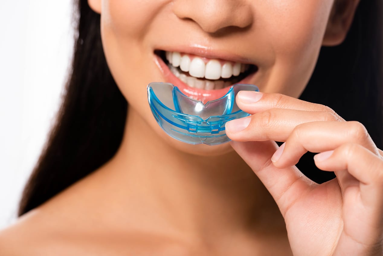 A woman smiling while holding a blue night guard