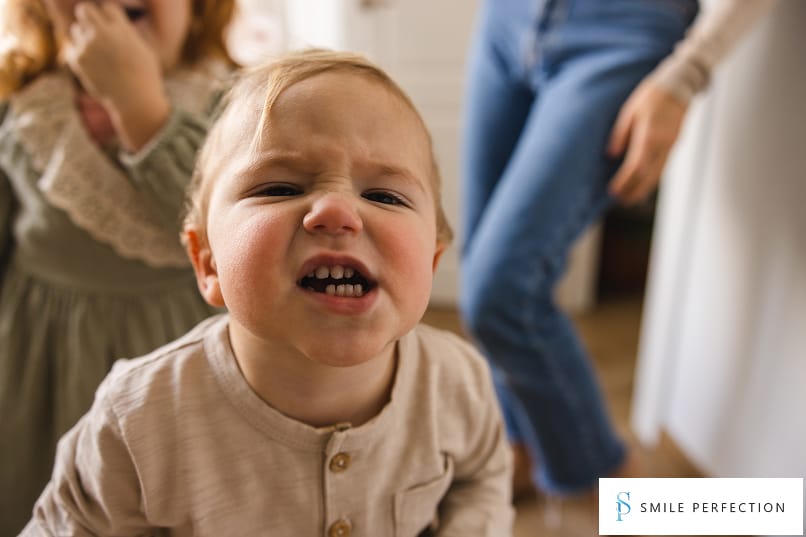 Toddler displaying early bite changes, illustrating how prolonged thumb-sucking without deterrents can affect dental development.